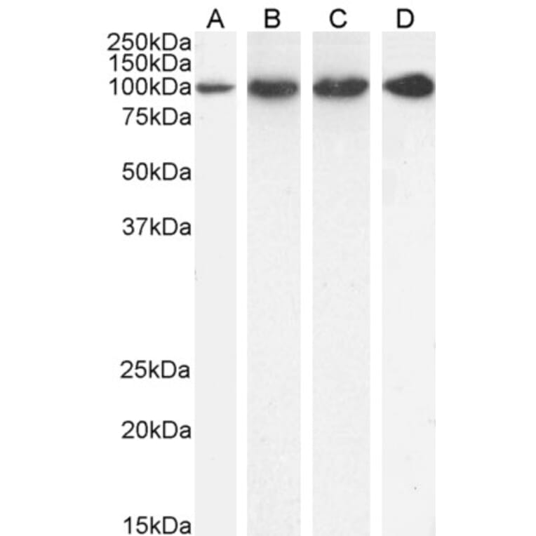 Western Blot - Anti-Proteasome 26S S2 Antibody (A84053) - Antibodies.com