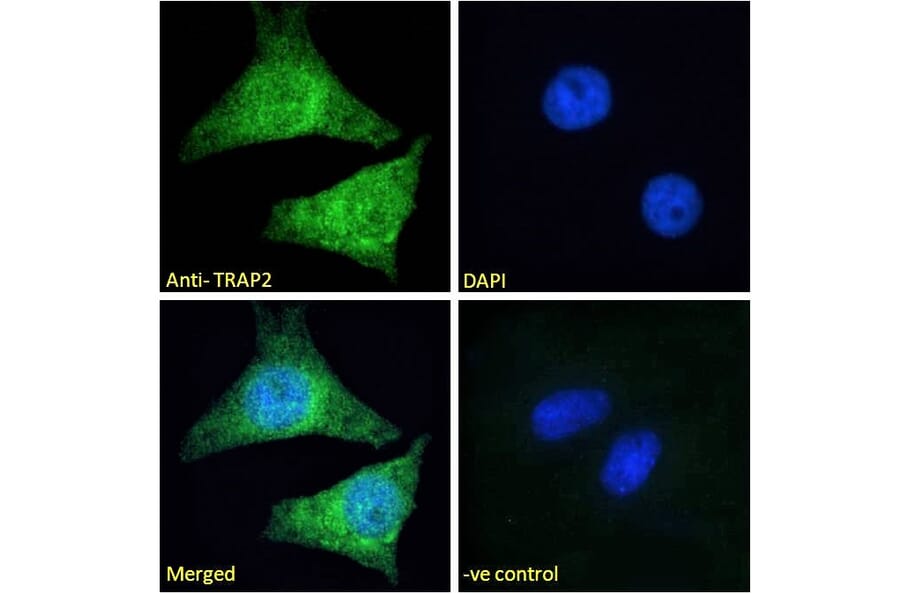 Immunofluorescence - Anti-Proteasome 26S S2 Antibody (A84053) - Antibodies.com