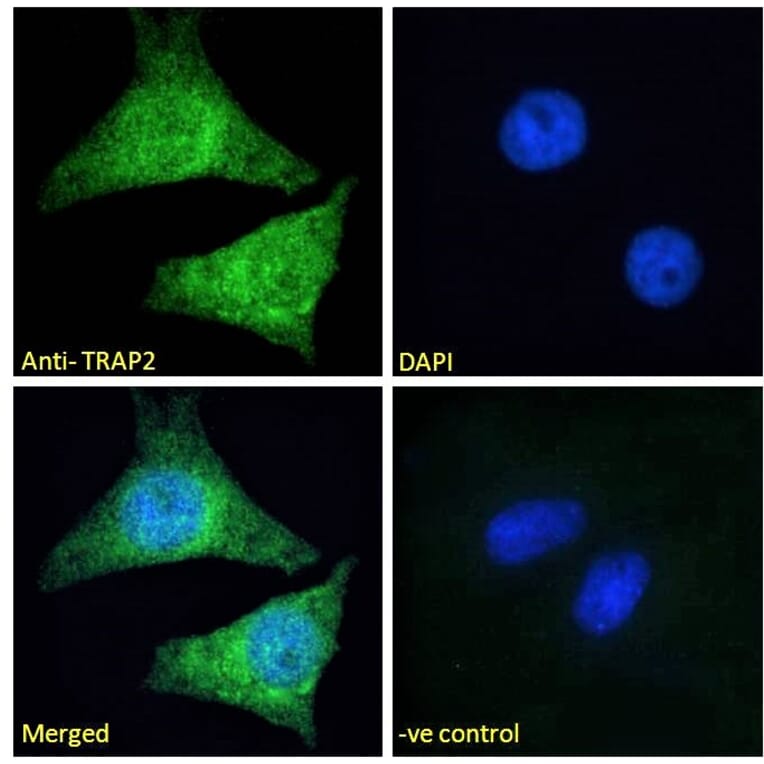 Immunofluorescence - Anti-Proteasome 26S S2 Antibody (A84053) - Antibodies.com