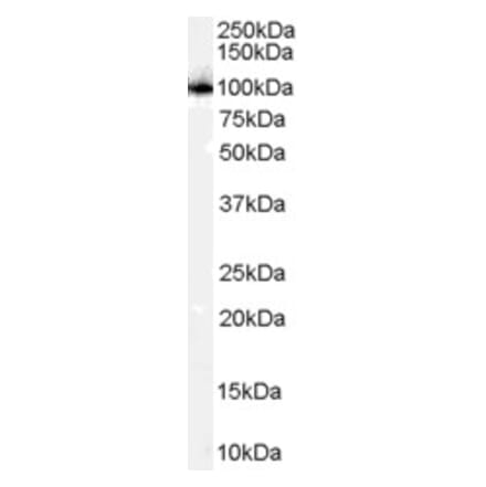 Western Blot - Anti-PSMD2 Antibody (A84053)