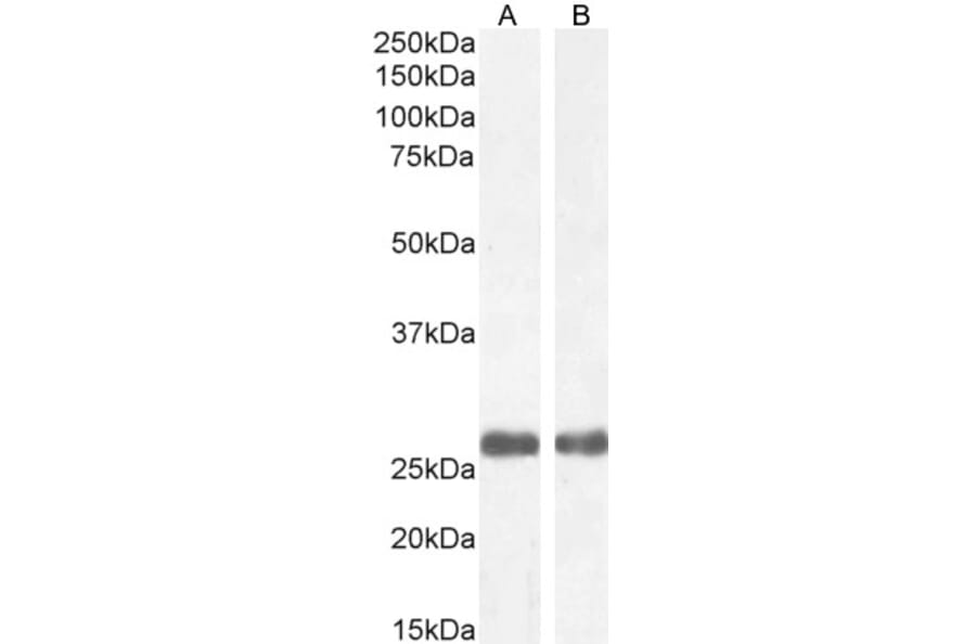 Western Blot - Anti-Mannan Binding Lectin/MBL Antibody (A84054) - Antibodies.com