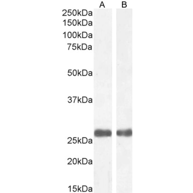 Western Blot - Anti-Mannan Binding Lectin/MBL Antibody (A84054) - Antibodies.com
