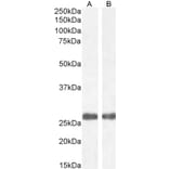 Western Blot - Anti-Mannan Binding Lectin/MBL Antibody (A84054) - Antibodies.com
