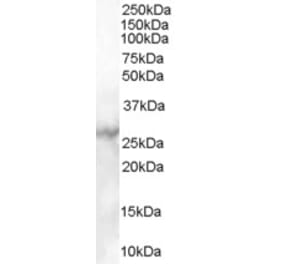 Western Blot - Anti-MBL2 Antibody (A84054) - Antibodies.com