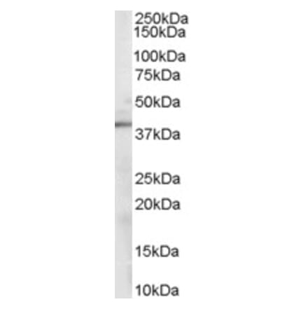 Western Blot - Anti-Sorbitol Dehydrogenase Antibody (A84056) - Antibodies.com