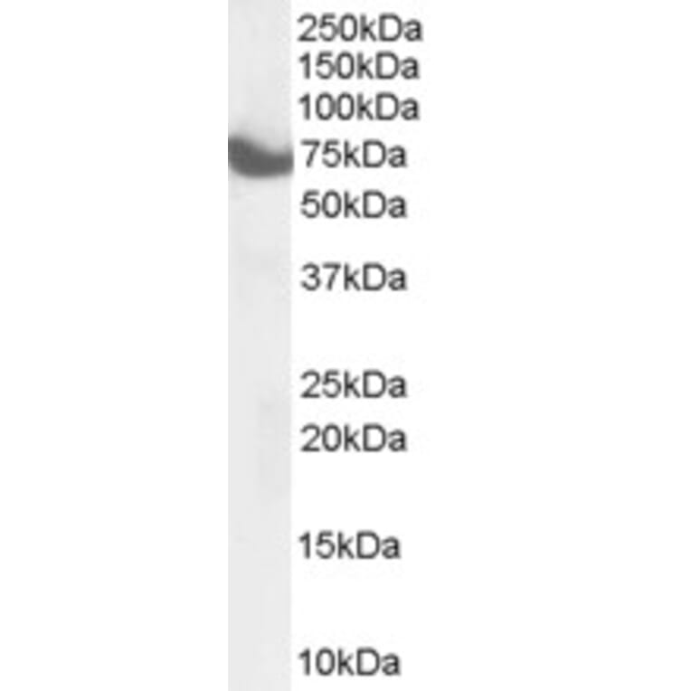 Western Blot - Anti-HIP14 Antibody (A84057) - Antibodies.com