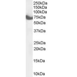 Western Blot - Anti-HIP14 Antibody (A84057) - Antibodies.com