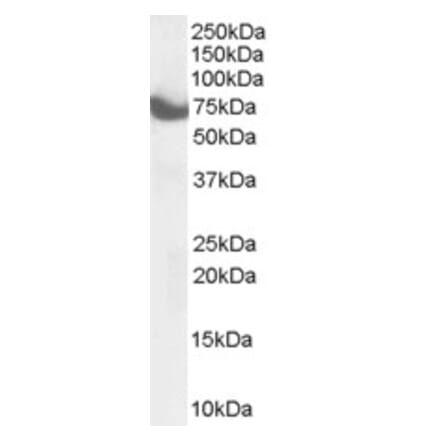 Western Blot - Anti-ZDHHC17 Antibody (A84057) - Antibodies.com