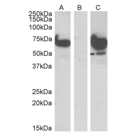 Western Blot - Anti-EPM2AIP1 Antibody (A84058) - Antibodies.com