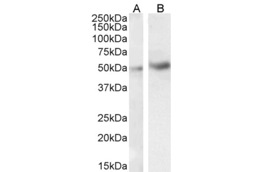 Western Blot - Anti-IRAK4 Antibody (A84059) - Antibodies.com