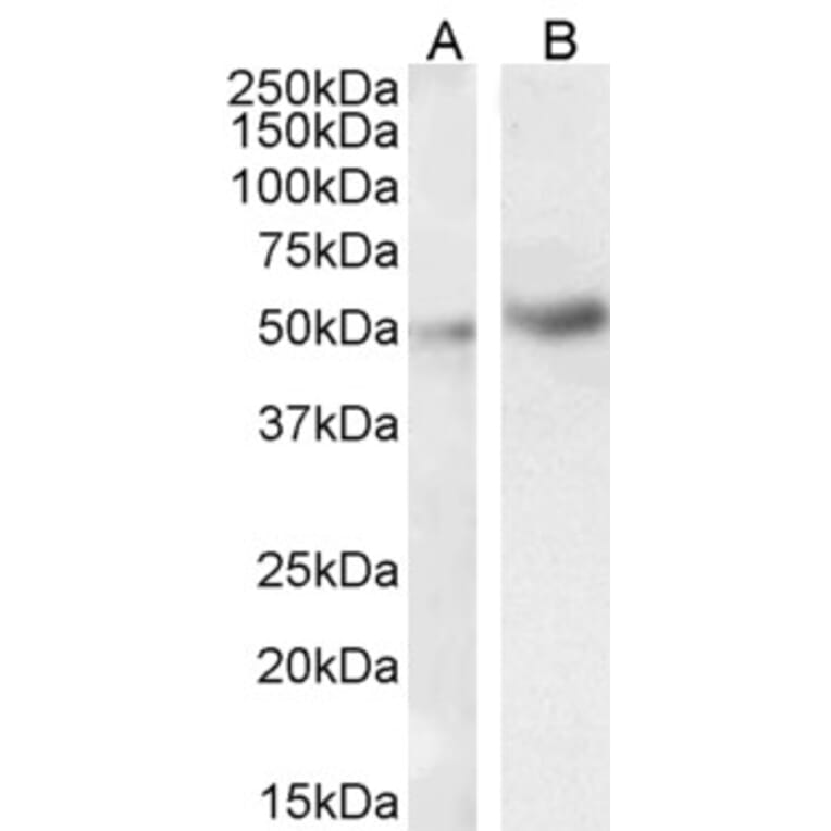 Western Blot - Anti-IRAK4 Antibody (A84059) - Antibodies.com