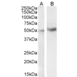 Western Blot - Anti-IRAK4 Antibody (A84059) - Antibodies.com