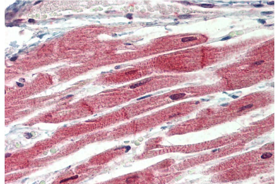 Immunohistochemistry - Anti-IRAK4 Antibody (A84059) - Antibodies.com