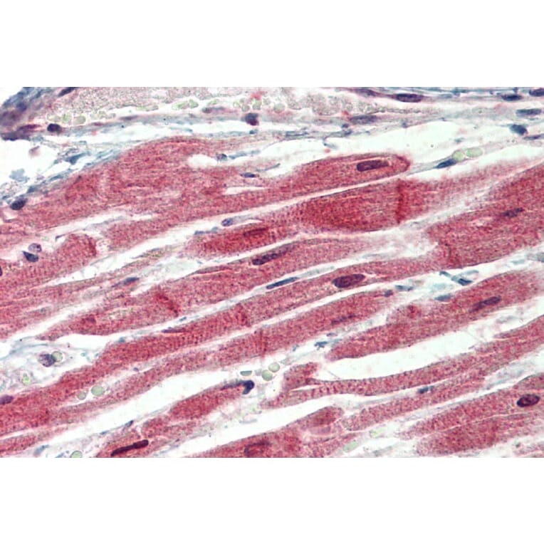 Immunohistochemistry - Anti-IRAK4 Antibody (A84059) - Antibodies.com