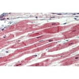Immunohistochemistry - Anti-IRAK4 Antibody (A84059) - Antibodies.com