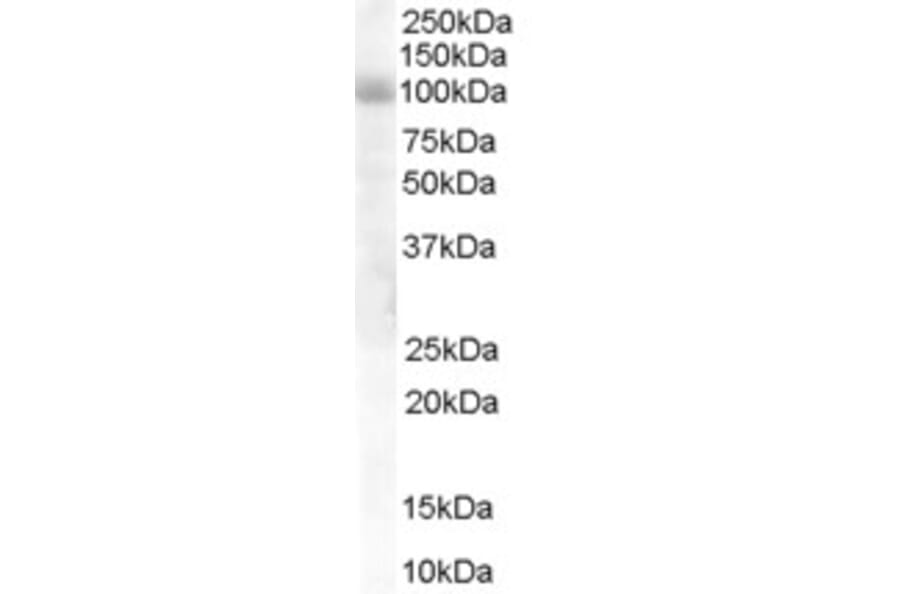 Western Blot - Anti-HPS6 Antibody (A84060) - Antibodies.com