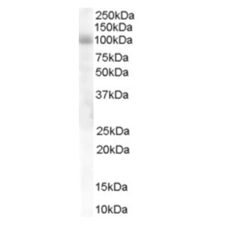 Western Blot - Anti-HPS6 Antibody (A84060) - Antibodies.com