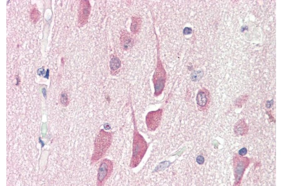 Immunohistochemistry - Anti-HPS6 Antibody (A84060) - Antibodies.com