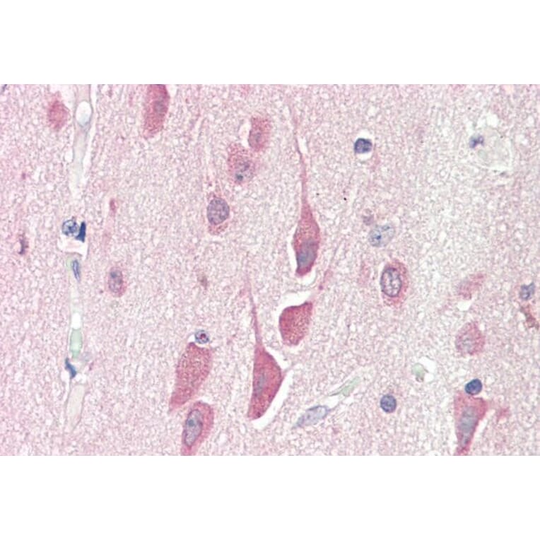 Immunohistochemistry - Anti-HPS6 Antibody (A84060) - Antibodies.com