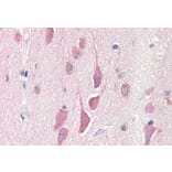 Immunohistochemistry - Anti-HPS6 Antibody (A84060) - Antibodies.com