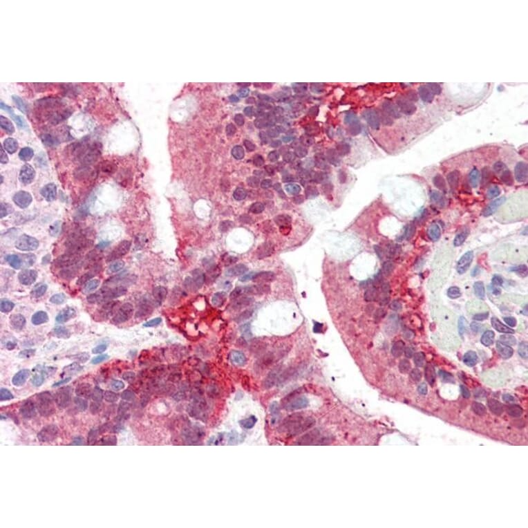 Immunohistochemistry - Anti-AKR1C3 Antibody (A84062) - Antibodies.com