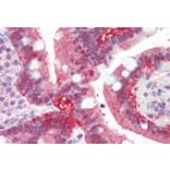 Immunohistochemistry - Anti-AKR1C3 Antibody (A84062) - Antibodies.com