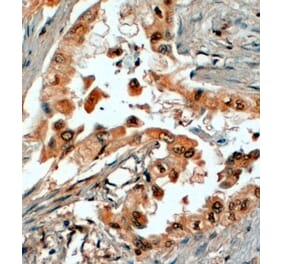 Immunohistochemistry - Anti-SRD5A1 Antibody (A84063) - Antibodies.com