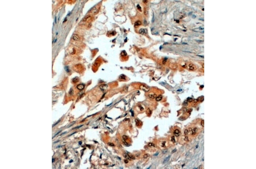 Immunohistochemistry - Anti-SRD5A1 Antibody (A84063) - Antibodies.com