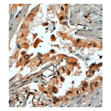 Immunohistochemistry - Anti-SRD5A1 Antibody (A84063) - Antibodies.com