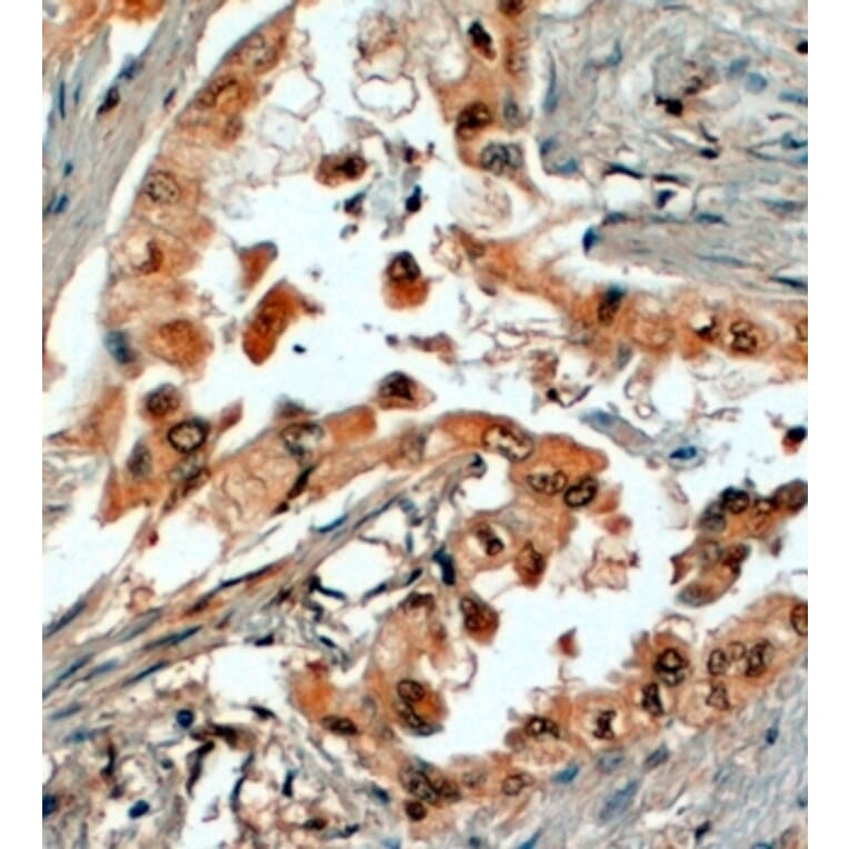 Immunohistochemistry - Anti-SRD5A1 Antibody (A84063) - Antibodies.com