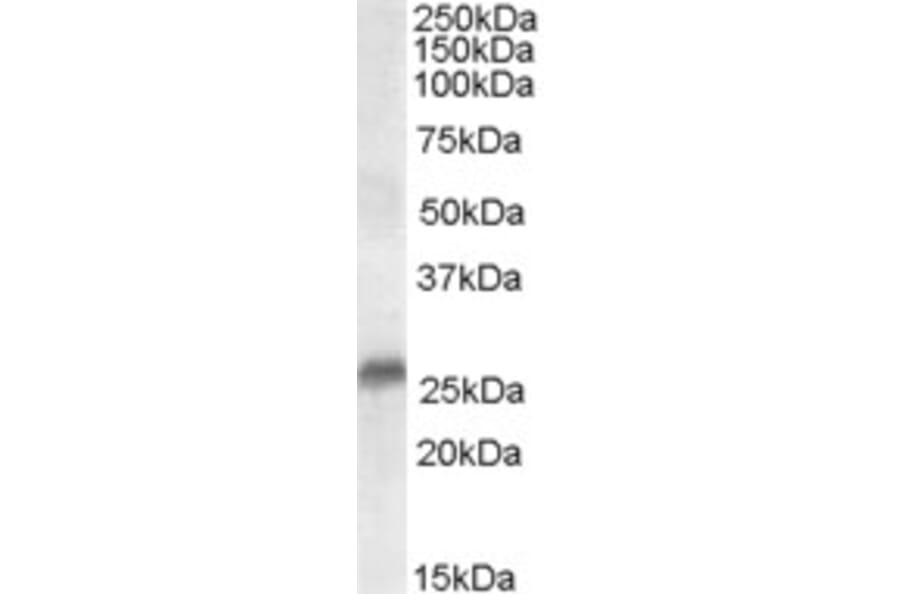 Western Blot - Anti-SRD5A2 Antibody (A84064) - Antibodies.com