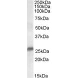 Western Blot - Anti-SRD5A2 Antibody (A84064) - Antibodies.com