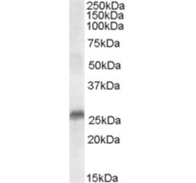 Western Blot - Anti-SRD5A2 Antibody (A84064) - Antibodies.com
