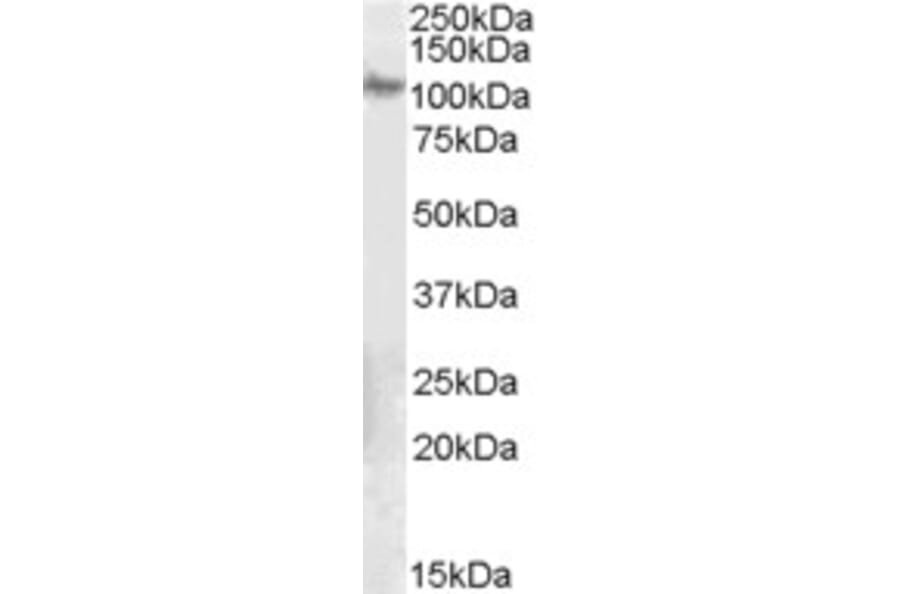 Western Blot - Anti-Integrin beta 5 Antibody (A84065) - Antibodies.com