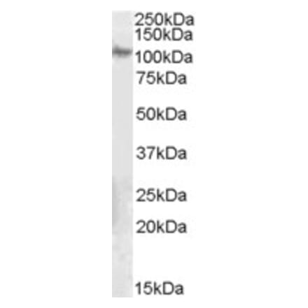 Western Blot - Anti-Integrin beta 5 Antibody (A84065) - Antibodies.com