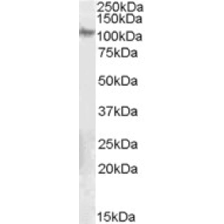 Western Blot - Anti-Integrin beta 5 Antibody (A84065) - Antibodies.com
