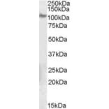 Western Blot - Anti-Integrin beta 5 Antibody (A84065) - Antibodies.com