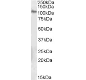 Western Blot - Anti-ITGB5 Antibody (A84065) - Antibodies.com