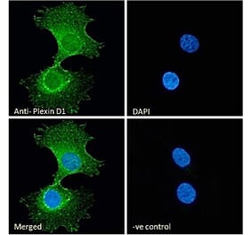 Immunofluorescence - Anti-Plexin D1 Antibody (A84067) - Antibodies.com