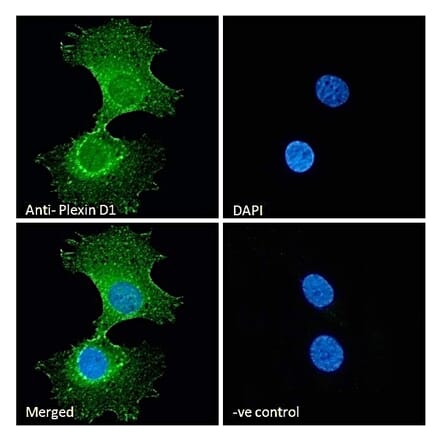 Immunofluorescence - Anti-Plexin D1 Antibody (A84067) - Antibodies.com