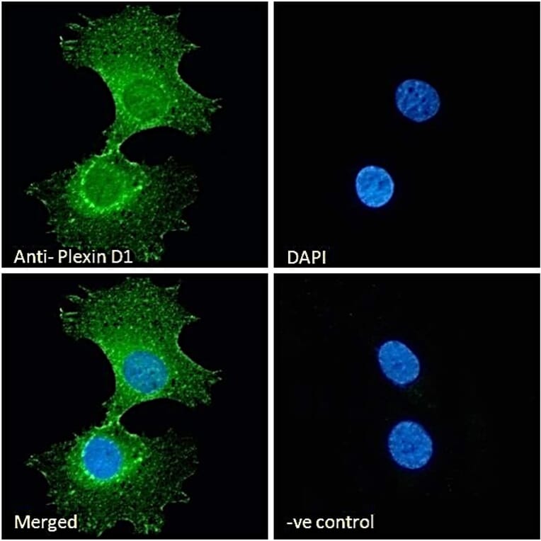 Immunofluorescence - Anti-Plexin D1 Antibody (A84067) - Antibodies.com