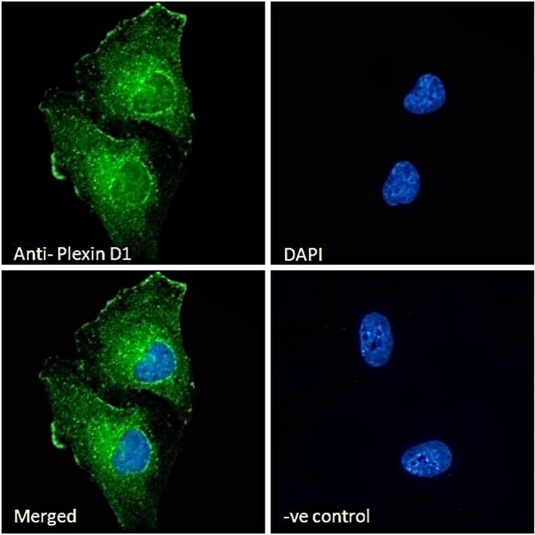 Immunofluorescence - Anti-Plexin D1 Antibody (A84067) - Antibodies.com