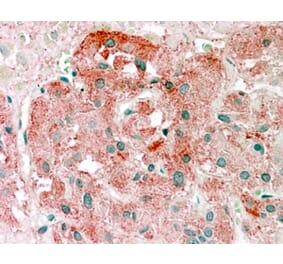Immunohistochemistry - Anti-Semaphorin 3E Antibody (A84068) - Antibodies.com