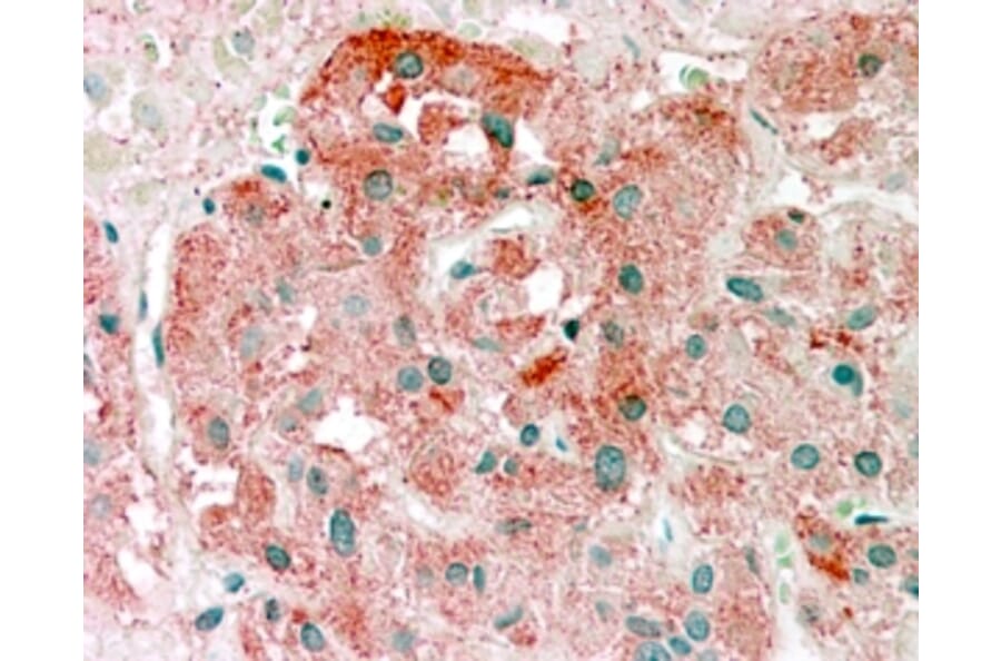Immunohistochemistry - Anti-Semaphorin 3E Antibody (A84068) - Antibodies.com