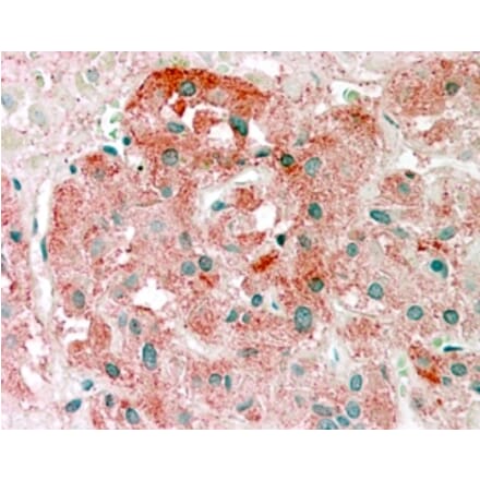 Immunohistochemistry - Anti-Semaphorin 3E Antibody (A84068) - Antibodies.com