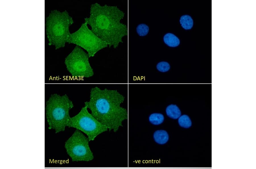 Immunofluorescence - Anti-Semaphorin 3E Antibody (A84068) - Antibodies.com