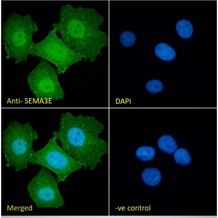 Immunofluorescence - Anti-Semaphorin 3E Antibody (A84068) - Antibodies.com