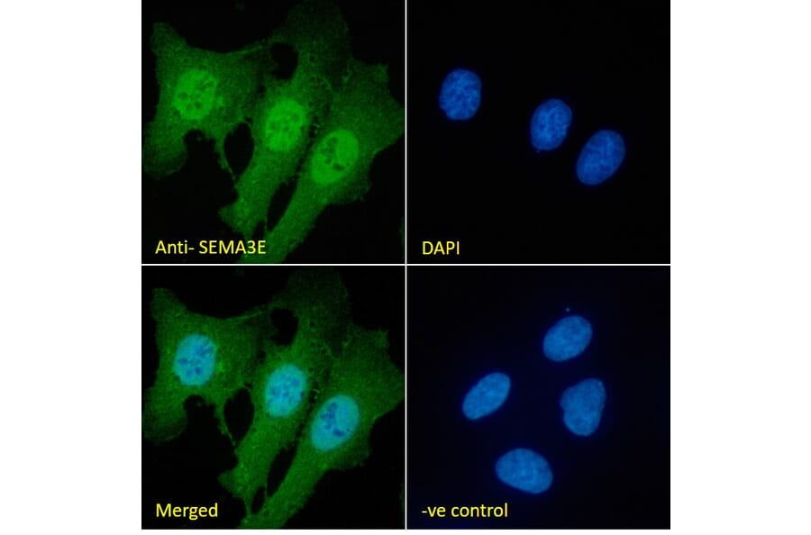 Immunofluorescence - Anti-Semaphorin 3E Antibody (A84068) - Antibodies.com