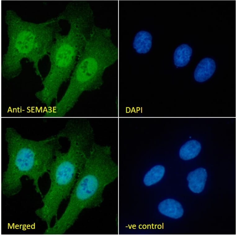 Immunofluorescence - Anti-Semaphorin 3E Antibody (A84068) - Antibodies.com