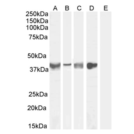 Western Blot - Anti-Asporin Antibody (A84069) - Antibodies.com